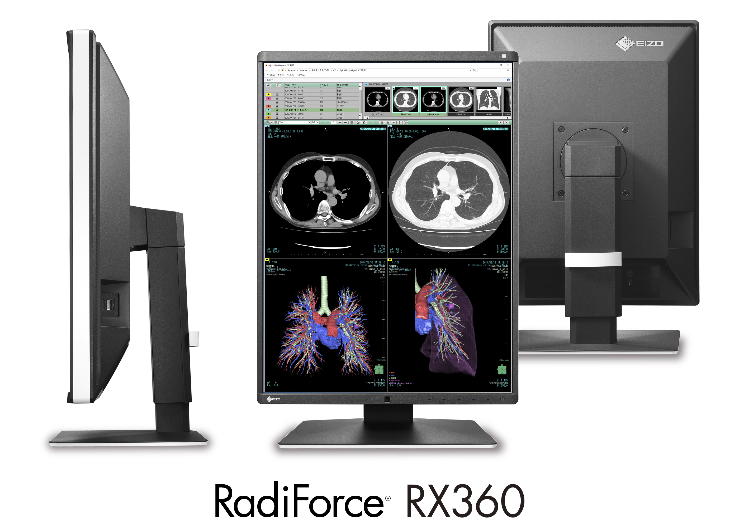 RX360