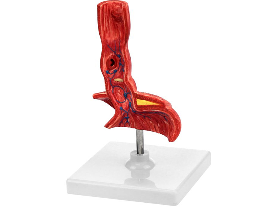 小肠结构模型胃解剖模型胃解剖模型牙保健模型口腔牙周病学教学实习